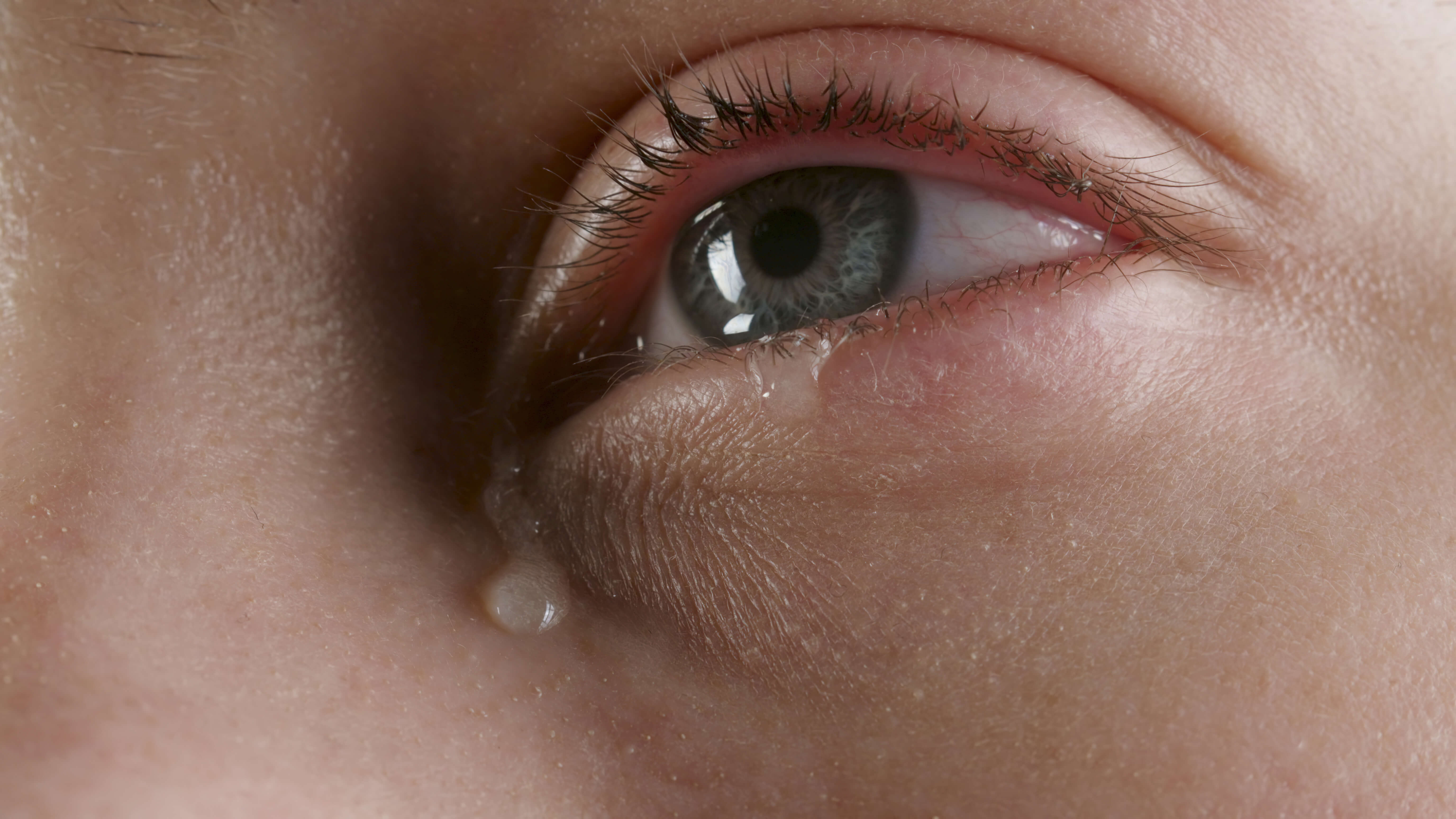 Savoir reconnaître une allergie oculaire | OPA Pratique