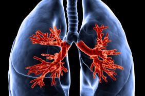 Mise à disposition du dupilumab‚ première biothérapie ciblant l’inflammation de type 2 dans l’asthme sévère