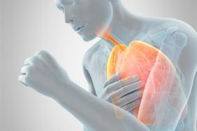 BPCO, le bisoprolol n’a pas d’effet sur les exacerbations