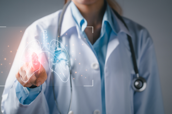 La survie des patients atteints de cancer bronchique