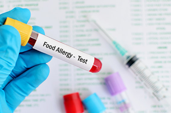 Test de provocation orale aux aliments : recommandations européennes