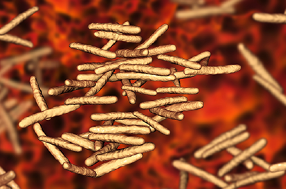 Infections à mycobactéries non tuberculeuses : de nouvelles recommandations