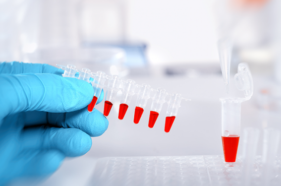 Quels biomarqueurs pour guider la prise en charge de l’asthme ?