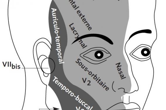 Céphalée primaire ou algie cranio-faciale ? | OPA Pratique